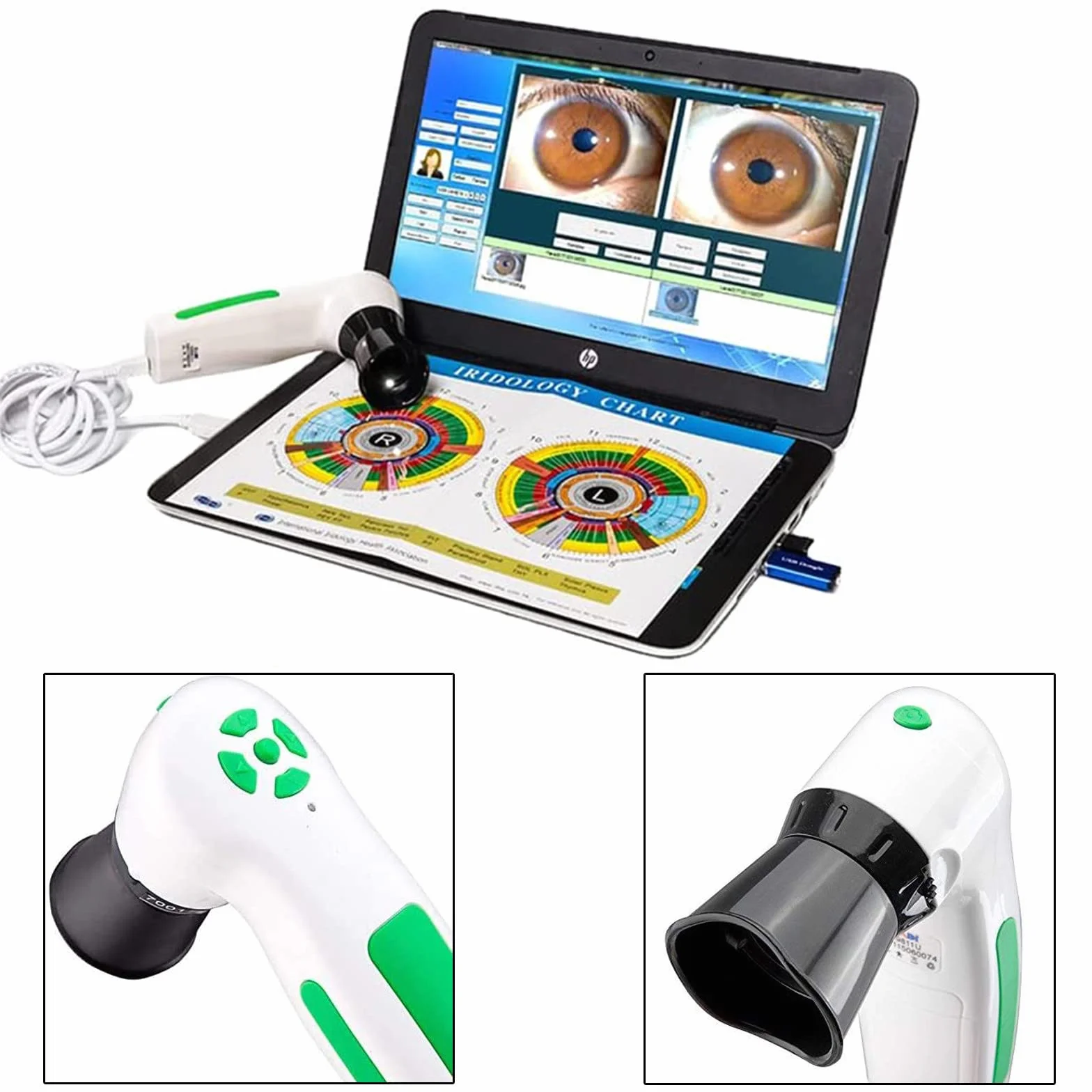 Analizzatore dell'iride Iridologia, Fotocamera per iridologia, Alta Risoluzione USB Iriscope Eye Camera, Iriscope con 30x Iris Lens e Software di Analisi