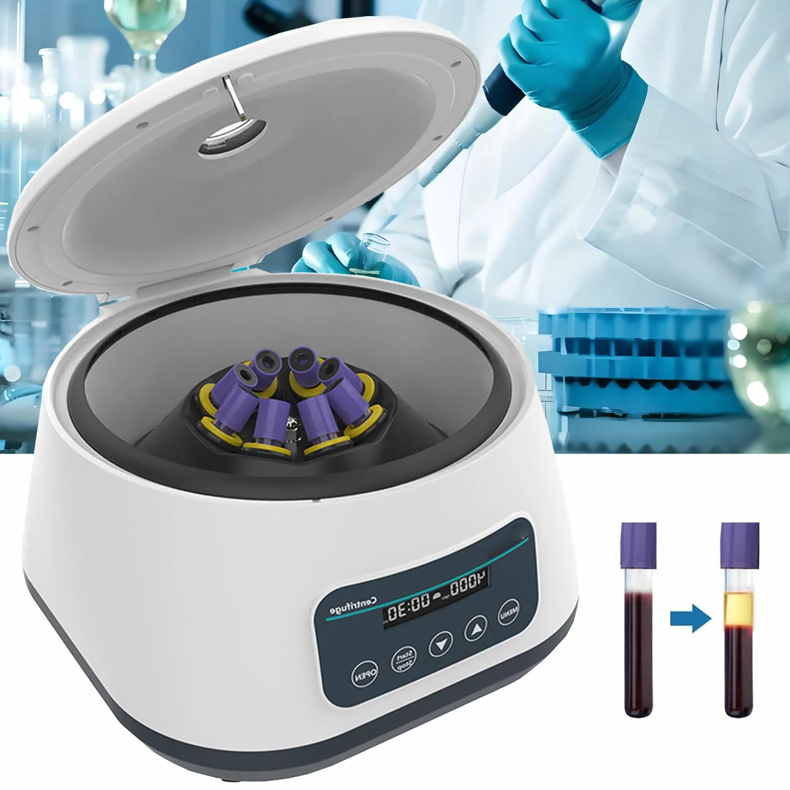 Centrifuga da Banco per Laboratorio PRP 8x2ml/5ml/10ml/15ml capacità Provette, Bassa velocità 500-5000rpm/Min, Max 2683xg RCF, Adatta per Pratica Medica Sangue/Siero/Plasma/Grasso,5000rpm