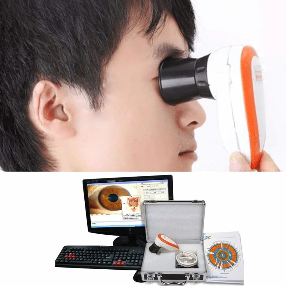 Home Care Wholesale 5.0 MP CCD ad Alta Risoluzione USB Iriscope Eye Camera Iriscope con 30x Iris Lens e Software di Analisi