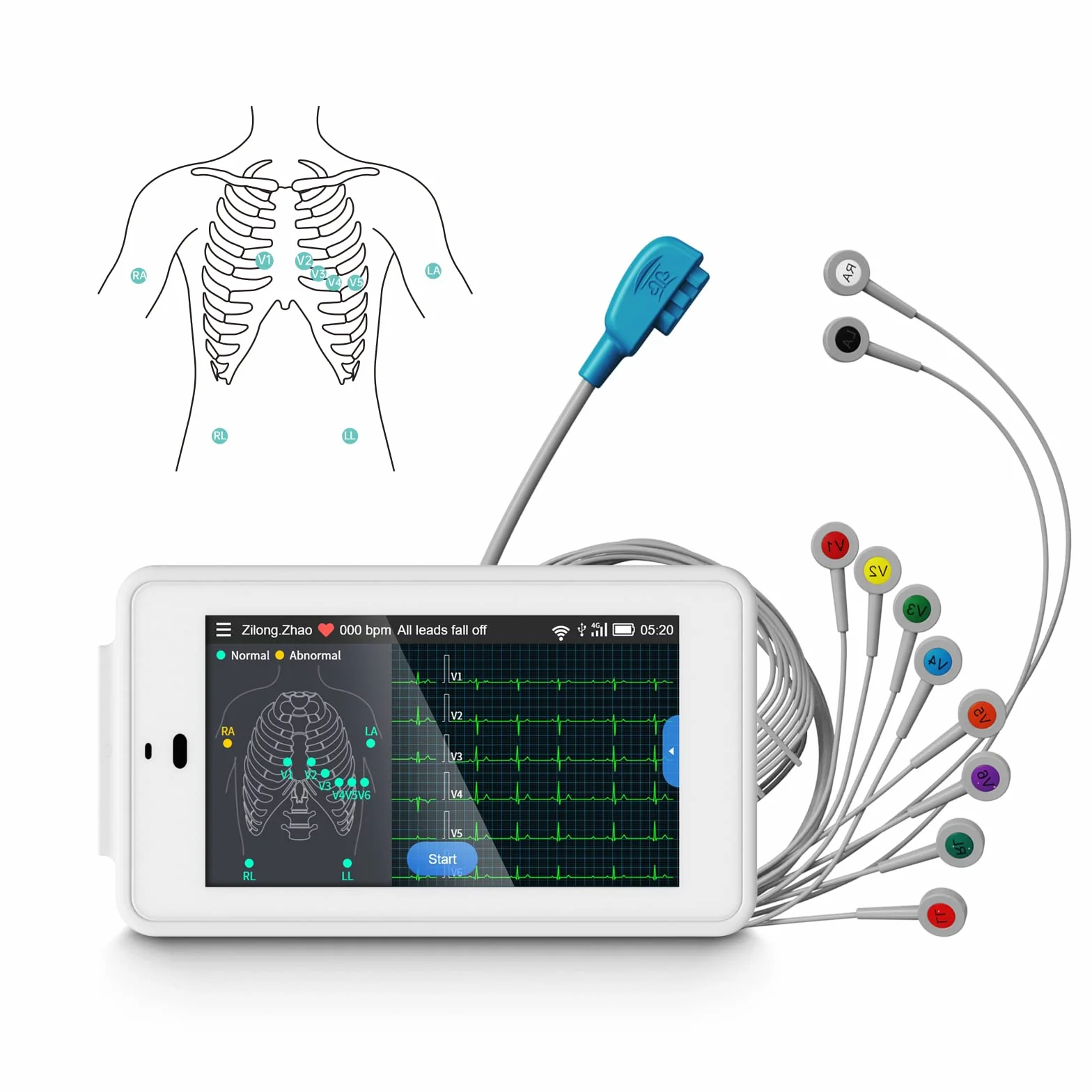 Wellue PG12 ECG professionale a 12 derivazioni, dispositivo ECG digitale con algoritmo di Glasgow, acquisizione e analisi dei dati ECG in tempo reale, trasferimento dati WIFI e stampa dei report