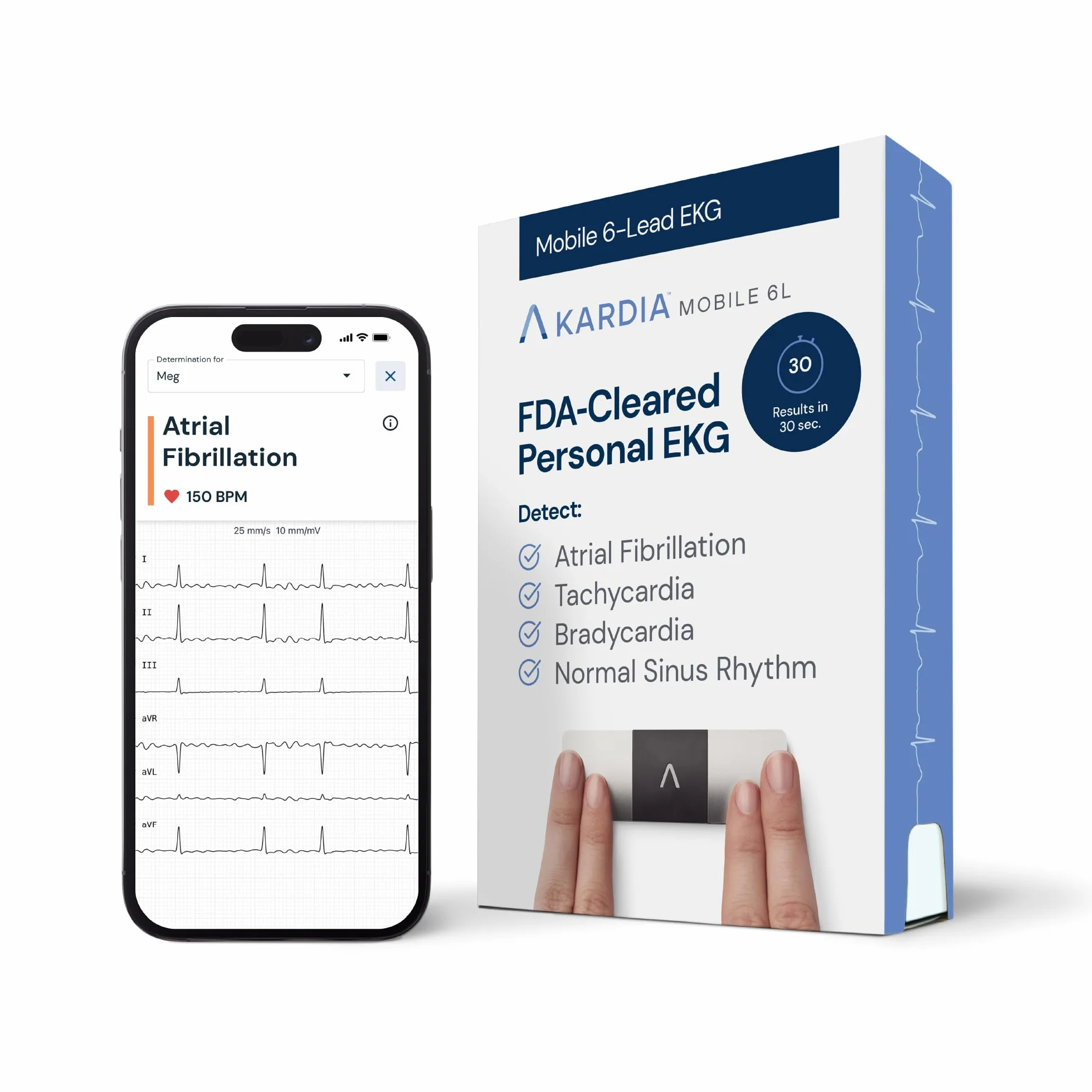 AliveCor KardiaMobile 6L ECG di livello medico | L’ECG Portatile a 6 Derivazioni | Rileva la Fibrillazione Atriale, Bradicardia e Tachicardia in Soli 30 Secondi | Distribuito da OMRON