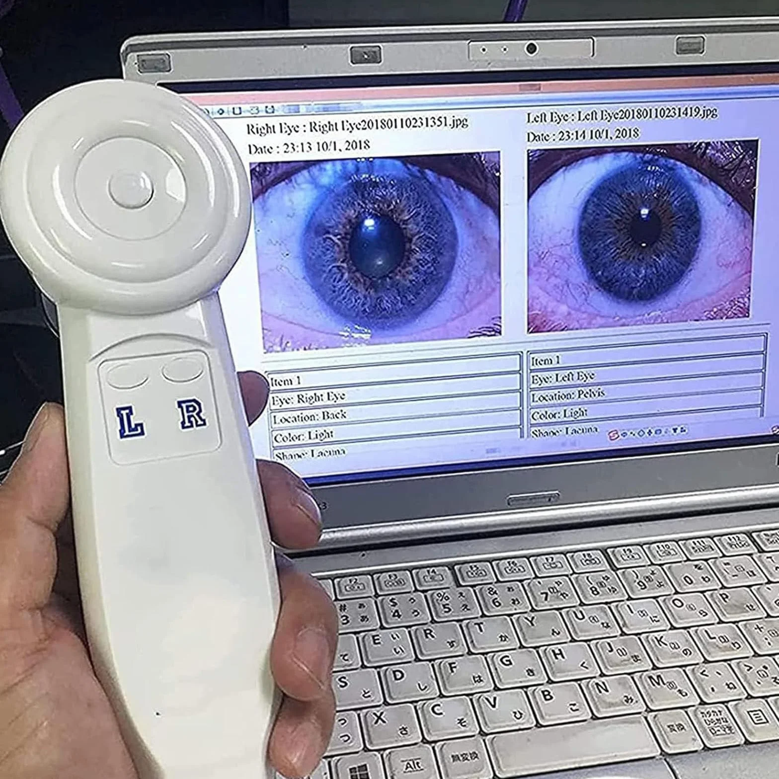 Telecamera iridoscopica medicale,Analizzatore Dell'iride Iridologia,USB iridoscopio Telecamera iridologica,Iris Software per diagnosi Eye