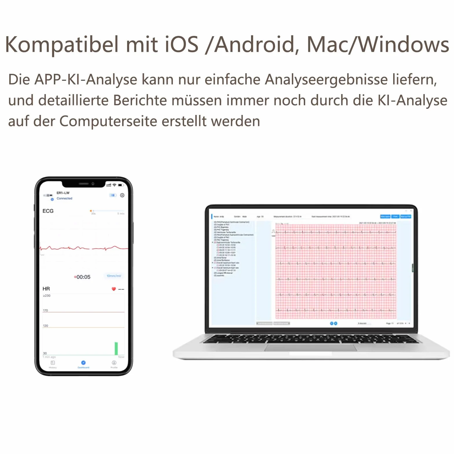 Wellue 24 ore dispositivo ECG per la casa, analisi AI, ECG Event Recorder, compatibile con Ios e Android, Mac e Windows, tempo di monitoraggio da 5 minuti a 24 ore