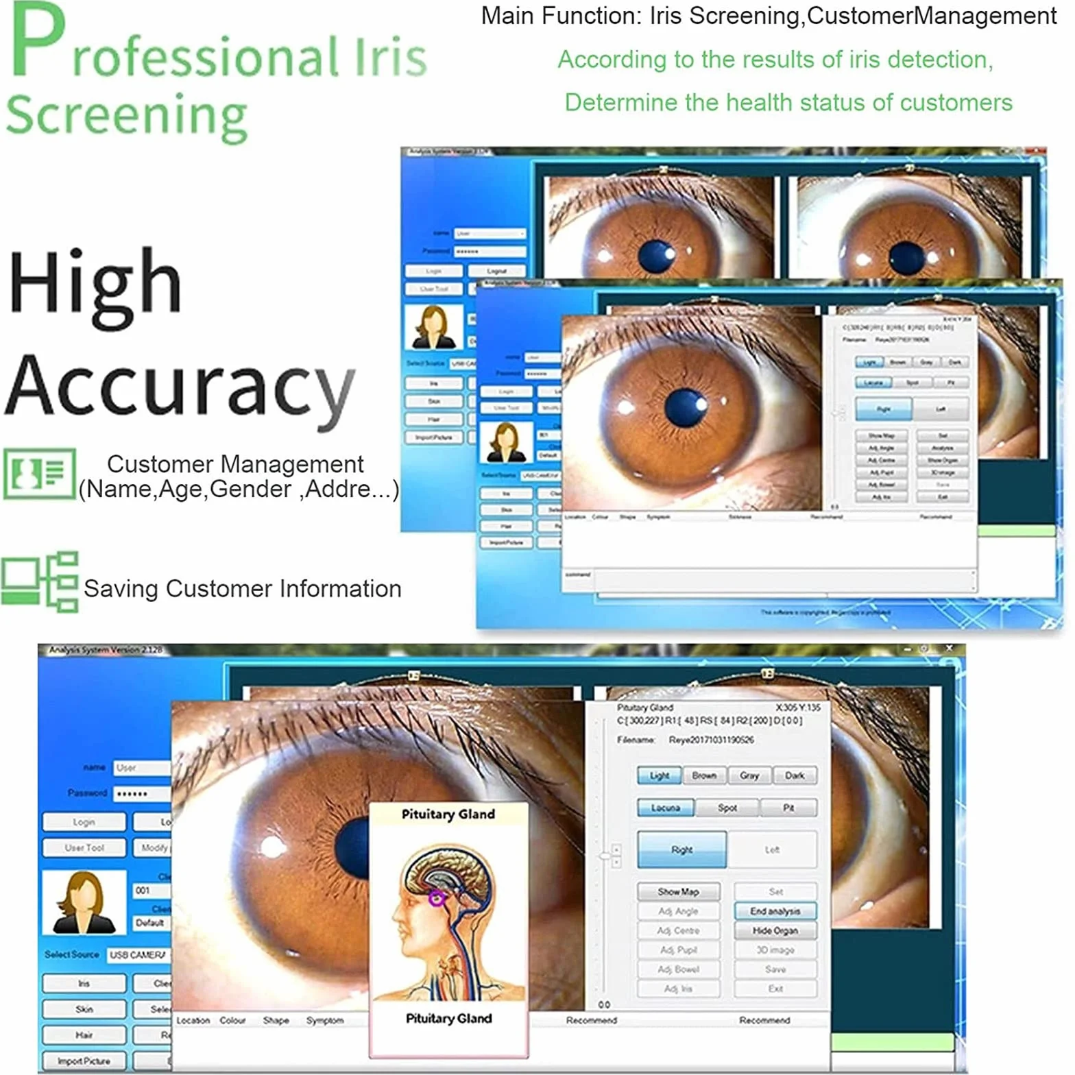 Analizzatore dell'iride Iridologia, Fotocamera per iridologia, Alta Risoluzione USB Iriscope Eye Camera, Iriscope con 30x Iris Lens e Software di Analisi