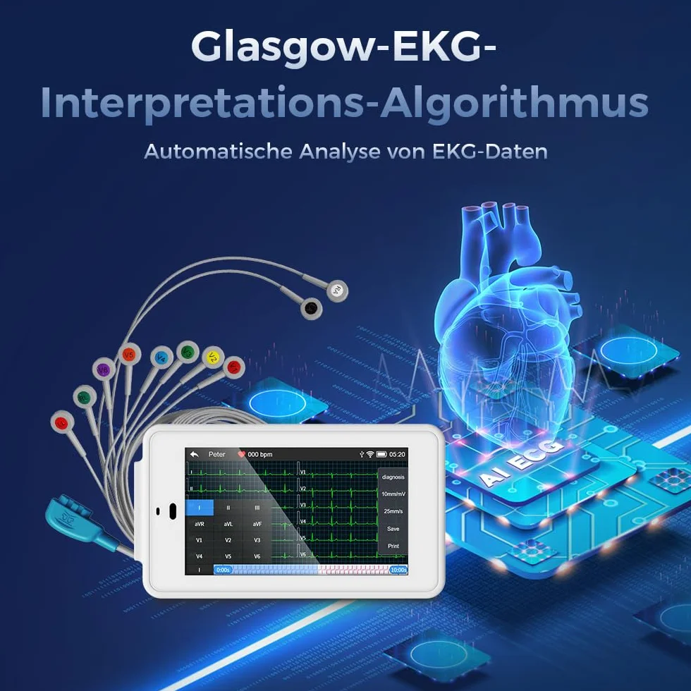 Wellue PG12 ECG professionale a 12 derivazioni, dispositivo ECG digitale con algoritmo di Glasgow, acquisizione e analisi dei dati ECG in tempo reale, trasferimento dati WIFI e stampa dei report