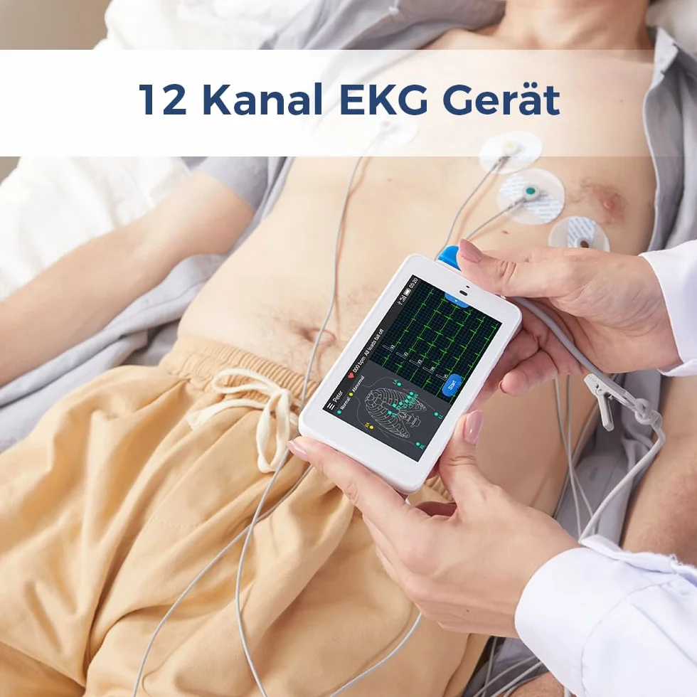 Wellue PG12 ECG professionale a 12 derivazioni, dispositivo ECG digitale con algoritmo di Glasgow, acquisizione e analisi dei dati ECG in tempo reale, trasferimento dati WIFI e stampa dei report