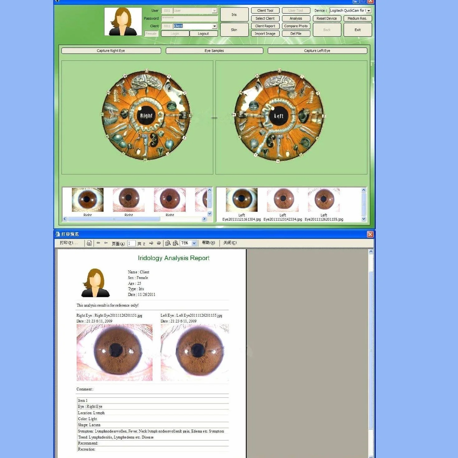 Home Care Wholesale 5.0 MP CCD ad Alta Risoluzione USB Iriscope Eye Camera Iriscope con 30x Iris Lens e Software di Analisi