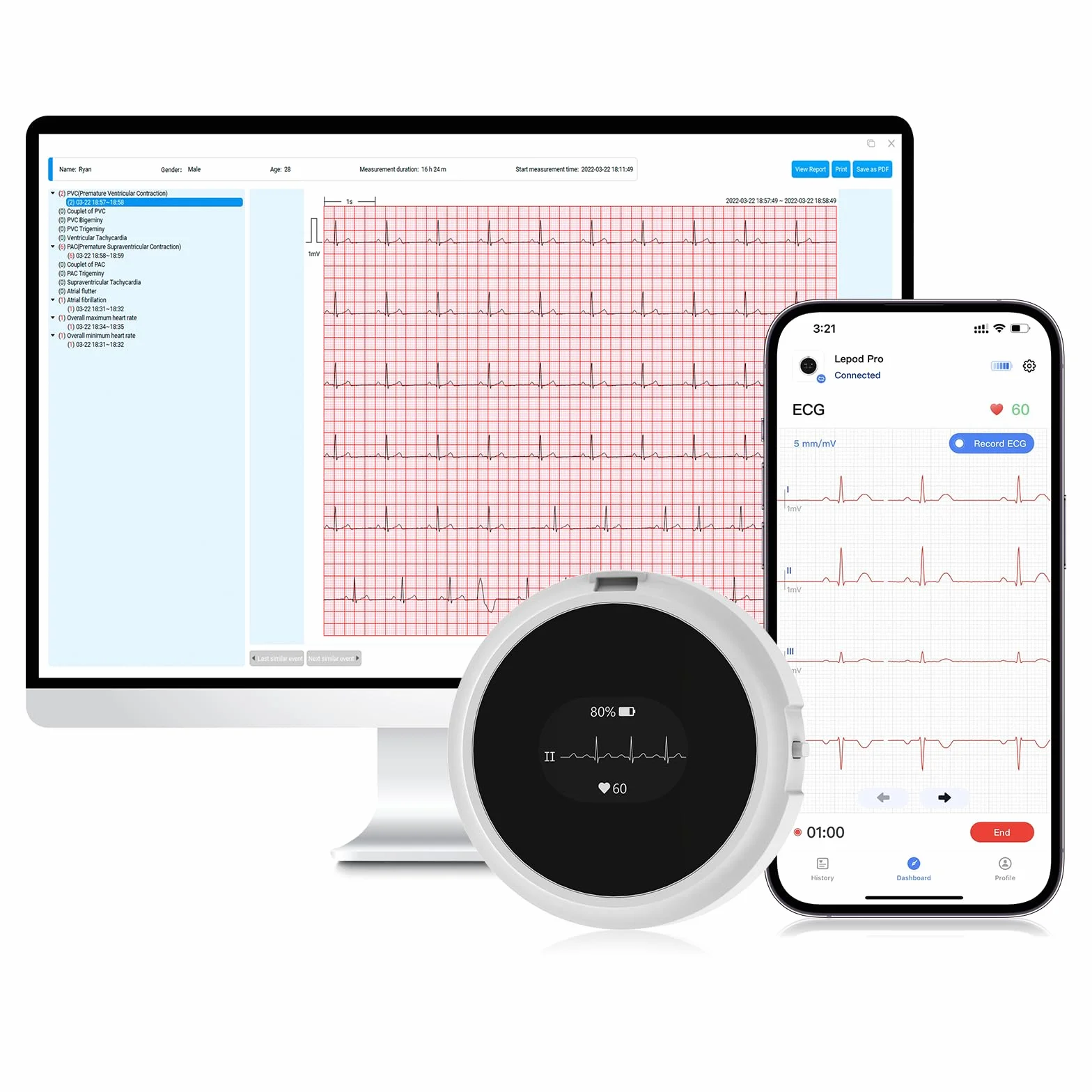CheckMe LepodPro ECG portatile a 12 derivazioni con display OLED, registrazione ECG in tempo reale per 24 ore, marcatori di eventi, report ECG AI dettagliato, ricaricabile supporto per app mobili e PC