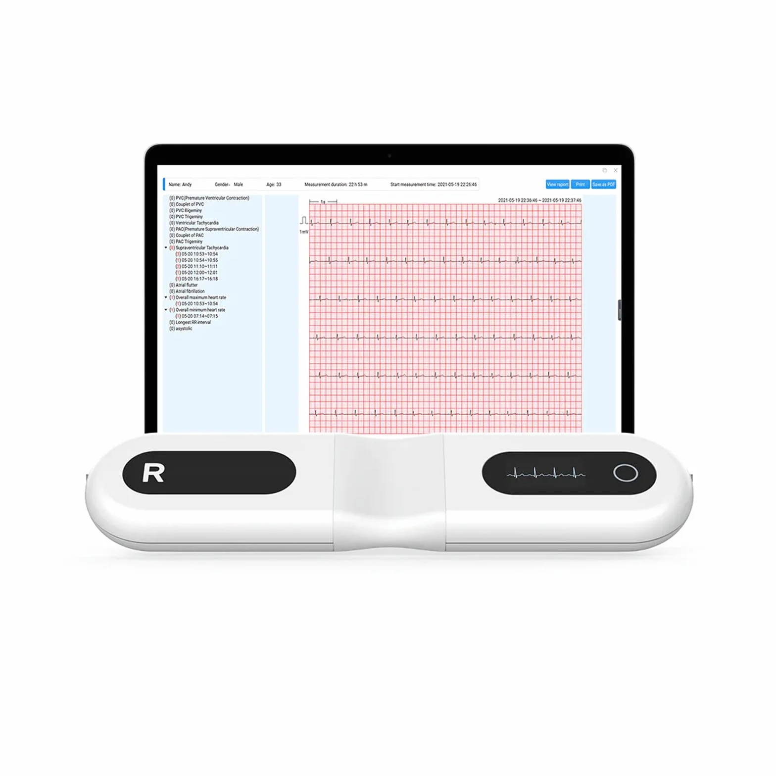 Wellue 24 ore dispositivo ECG per la casa, analisi AI, ECG Event Recorder, compatibile con Ios e Android, Mac e Windows, tempo di monitoraggio da 5 minuti a 24 ore