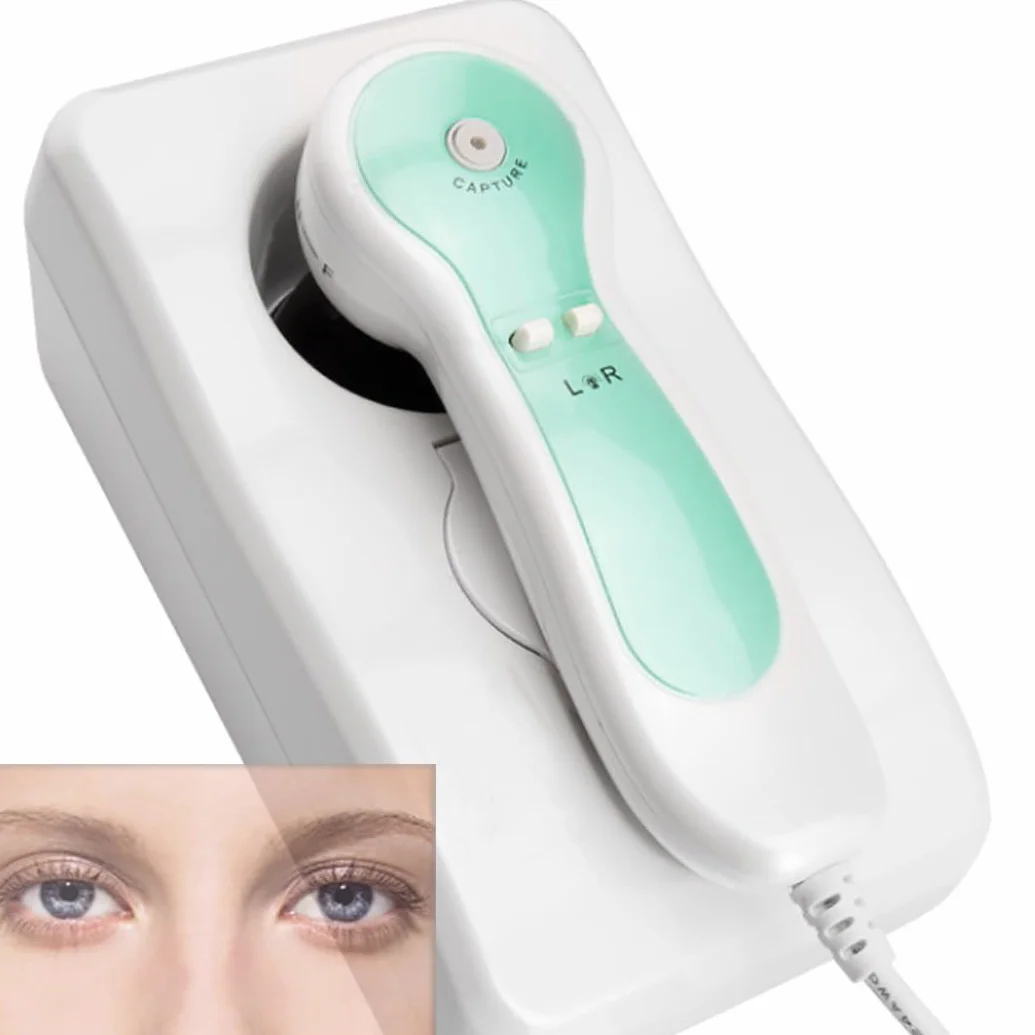 Analizzatore Dell'iride Iridologia,Fotocamera per iridologia con analizzatore dell'iride USB,analizzatore dell'iride,5mp,per Centro Benessere, Salone di Bellezza, Spa A