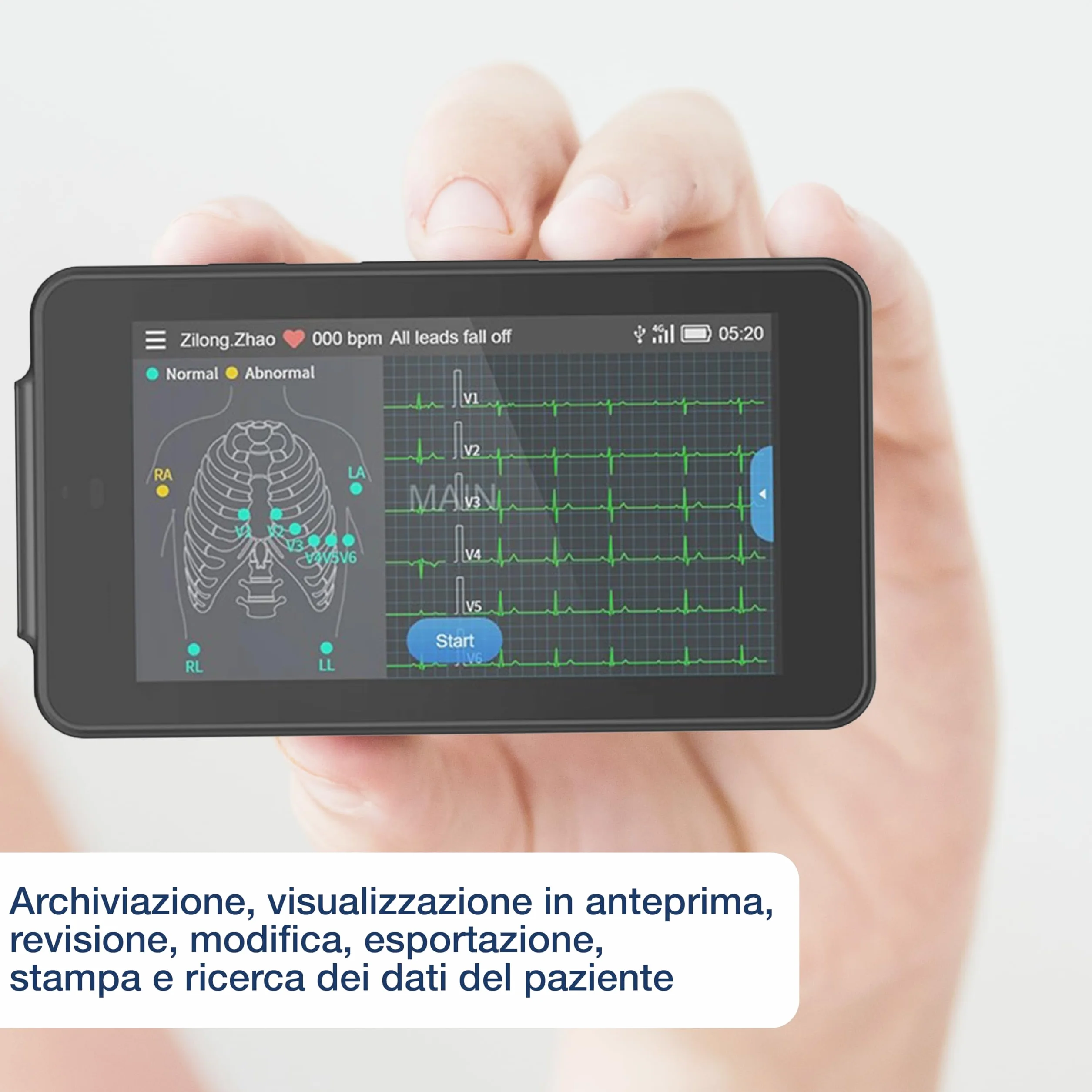 "PX31" MONITOR ECG TASCABILE PCECG-500