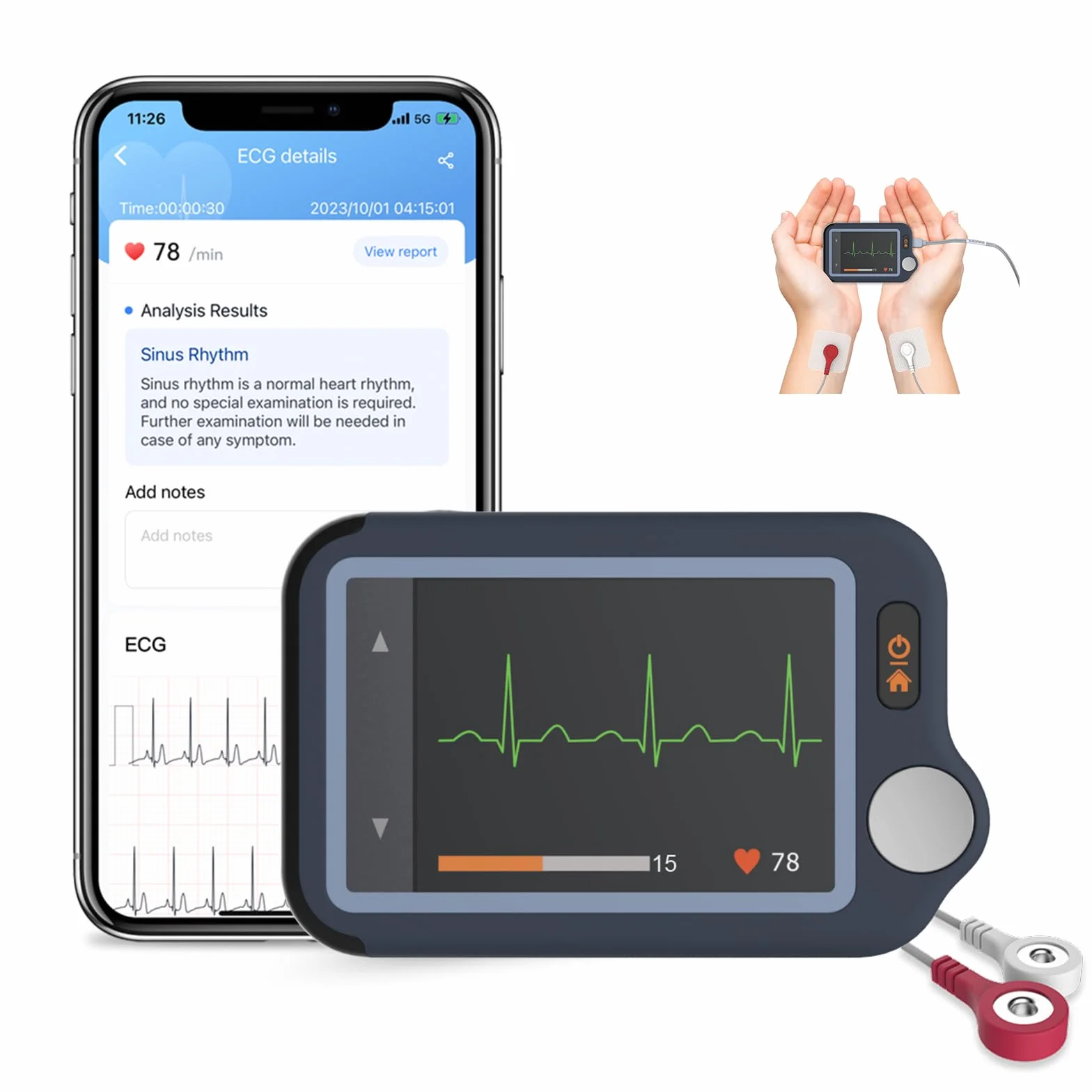 CheckMe Plus Monitor ECG per Uso Domestico,Funzione di Analisi ECG,30s/60s/5min ECG Portatile con Visualizzazione in Tempo Reale, Registra Prima, Carica Dopo, Memoria Illimitata (Smartphone/PC)