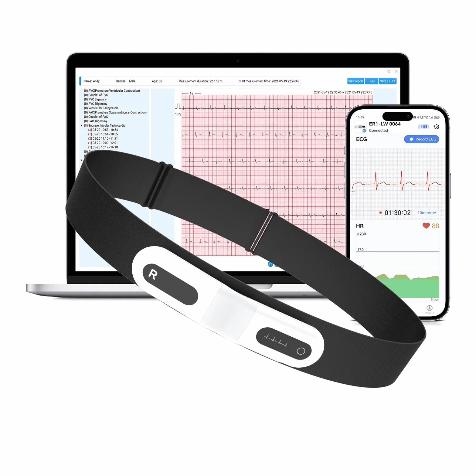 CheckMe ER1-LW Monitor ECG Portatile per 72 Ore con Analisi ECG AI,Holter ECG monitor con Schermo OLED,Funzione Marcatore Evento ECG,App e PC-software,Compatibile con Elettrodi a scatto da 4 mm