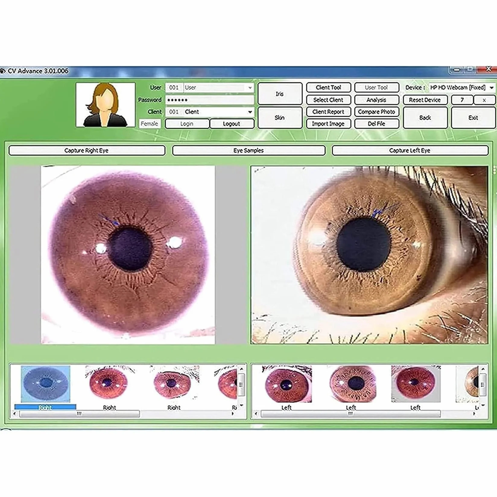 Telecamera per Iridologia, Telecamera per L'Analisi Dell'Iride con Lente Dell'Iride da 1,3 Milioni di Pixel, Rilevatore Dell'Iride, con Software Professionale, con Messa A Fuoco Regolabile