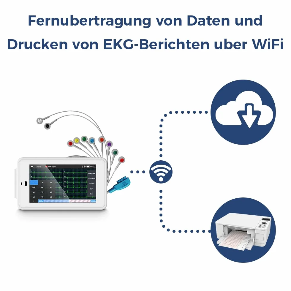 Wellue PG12 ECG professionale a 12 derivazioni, dispositivo ECG digitale con algoritmo di Glasgow, acquisizione e analisi dei dati ECG in tempo reale, trasferimento dati WIFI e stampa dei report