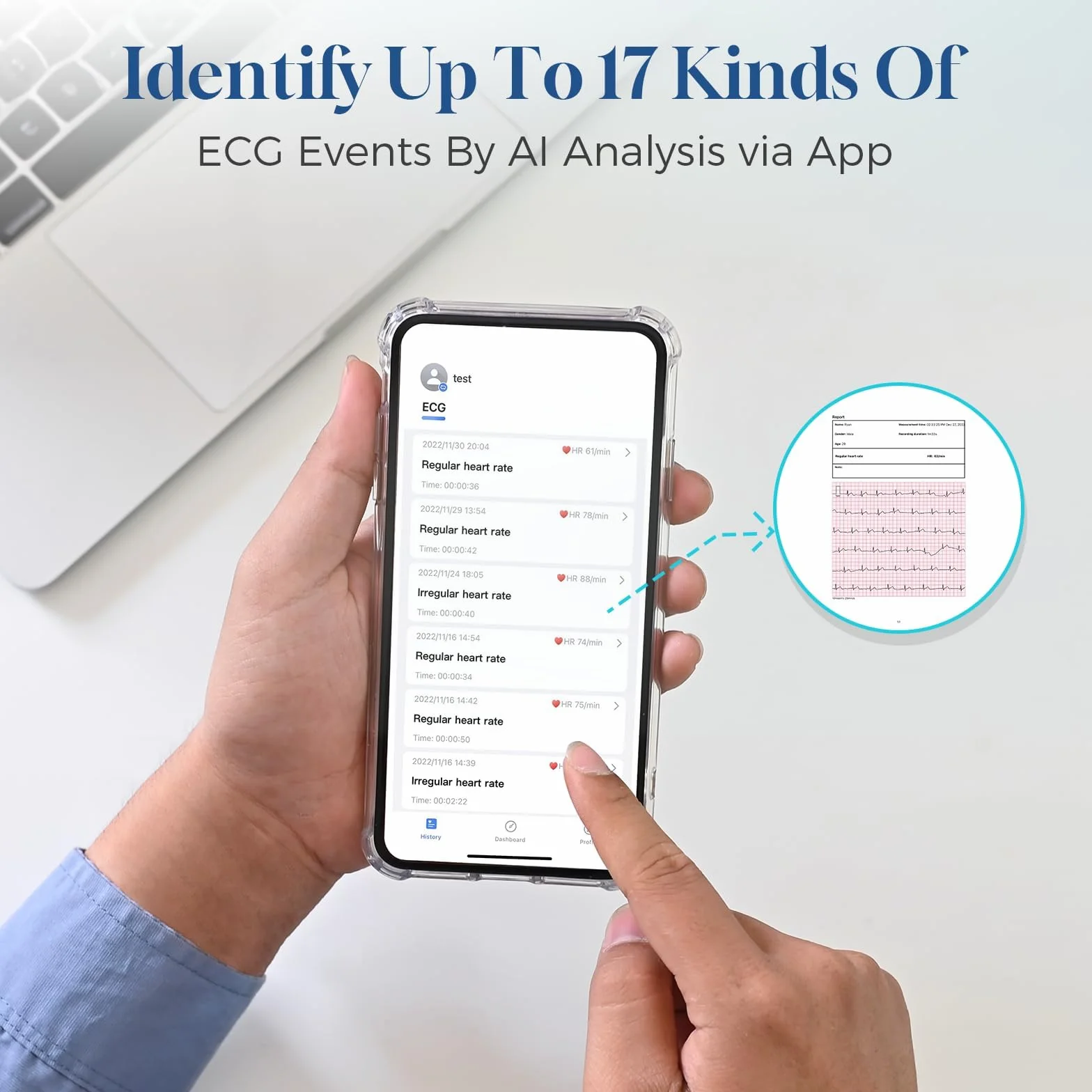 CheckMe ER2-S EKG per casa, dispositivo EKG portatile con fascia toracica precisa (registrazione da 30 secondi a 15 minuti), visualizzazione in tempo reale tramite app, spazio di archiviazione illimit