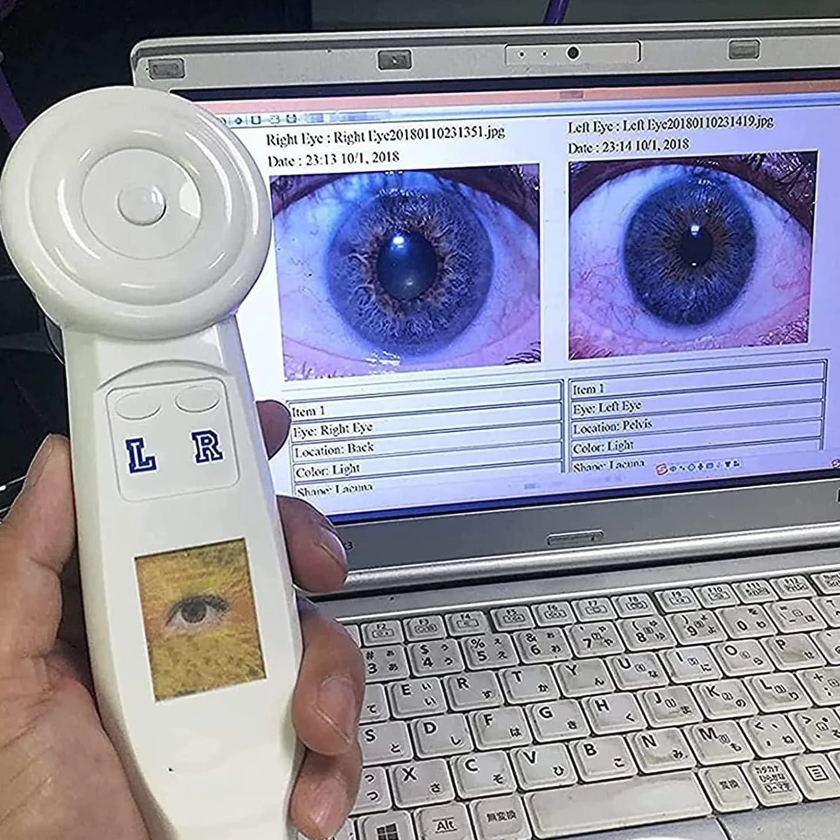 Telecamera per Iridologia, Telecamera per L'Analisi Dell'Iride con Lente Dell'Iride da 1,3 Milioni di Pixel, Rilevatore Dell'Iride, con Software Professionale, con Messa A Fuoco Regolabile