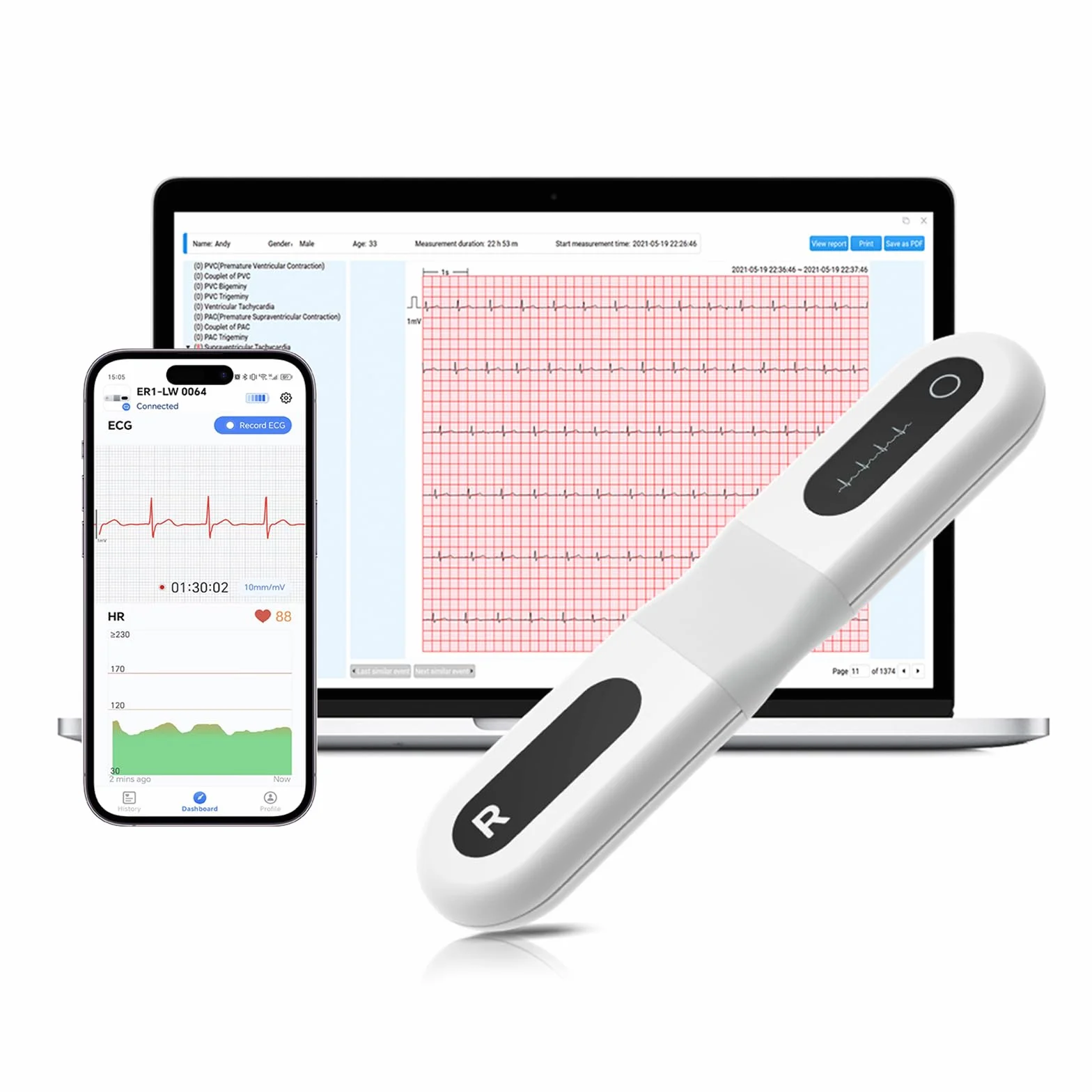 CheckMe ER1-LW Monitor ECG Portatile per 24 Ore per Uso Domestico, Analisi ECG AI Holter ECG con Schermo OLED, Funzione Marcatore Evento ECG, Compatibile con Elettrodi a scatto da 4 mm