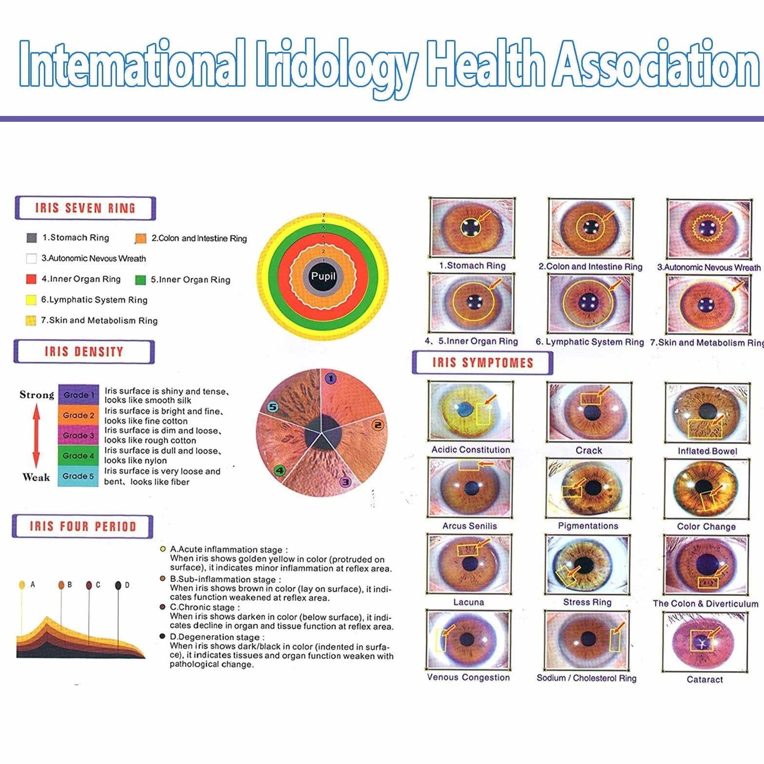 Analizzatore dell'iride Iridologia, Fotocamera per iridologia, Alta Risoluzione USB Iriscope Eye Camera, Iriscope con 30x Iris Lens e Software di Analisi