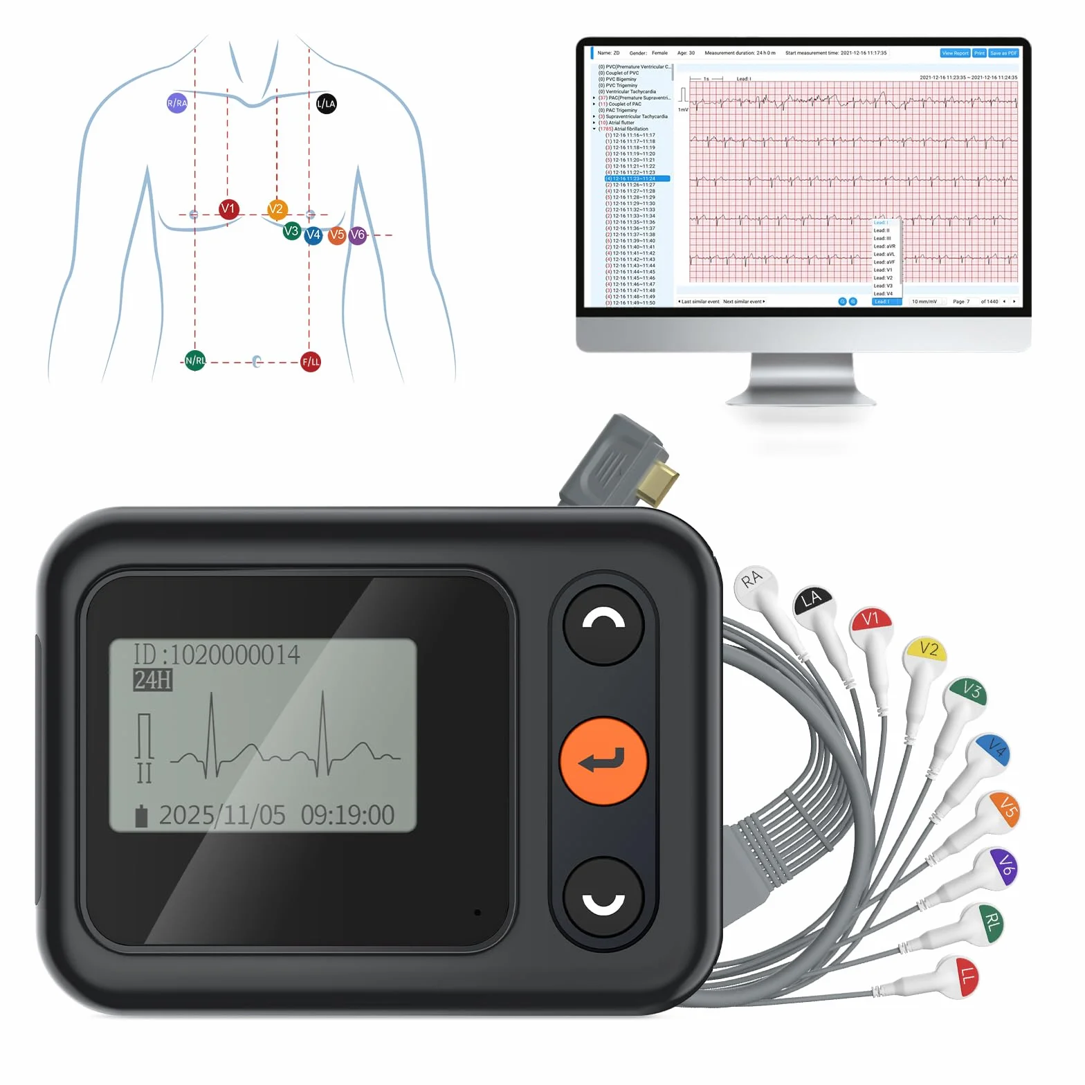 CheckMe 2026 ECG Aggiornato per Casa & ECG 12 Derivazioni – Analisi IA Potente e Registrazione Completa 24h: Monitor Holter Portatile per Monitoraggio Cardiaco Continuo con Software PC/Mac