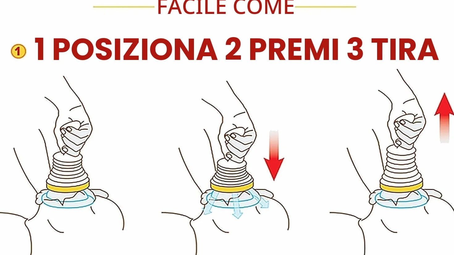 LifeVac Dispositivo antisoffocamento - Kit da viaggio
