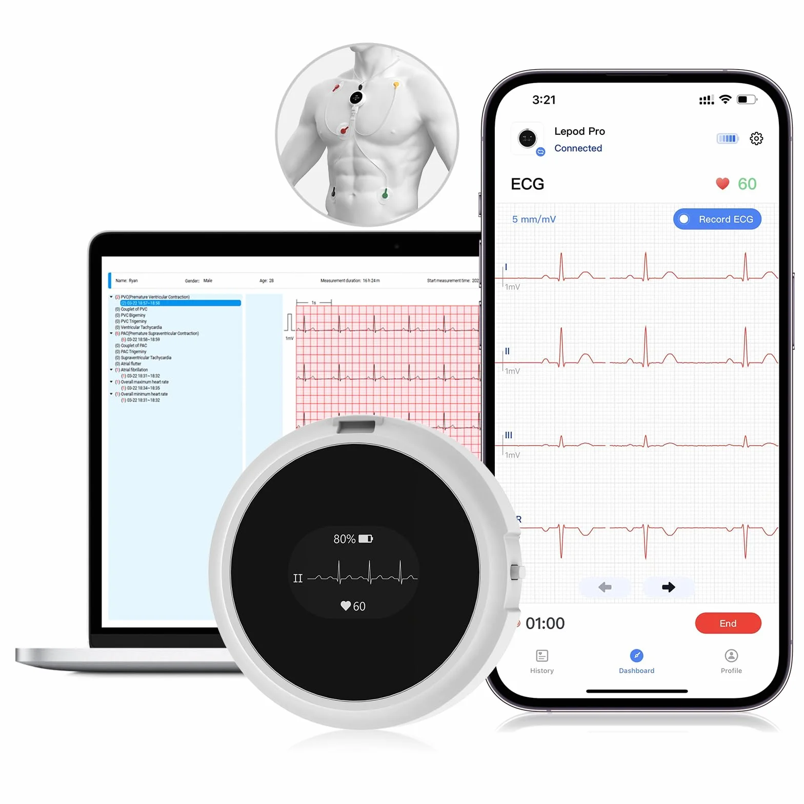 CheckMe LepodPro Monitor ECG a 7 derivazioni, registrazione ECG in tempo reale per 24 ore, report ECG AI dettagliati, marcatori di eventi, durata della batteria di 72 ore, supporto per smartphone e PC