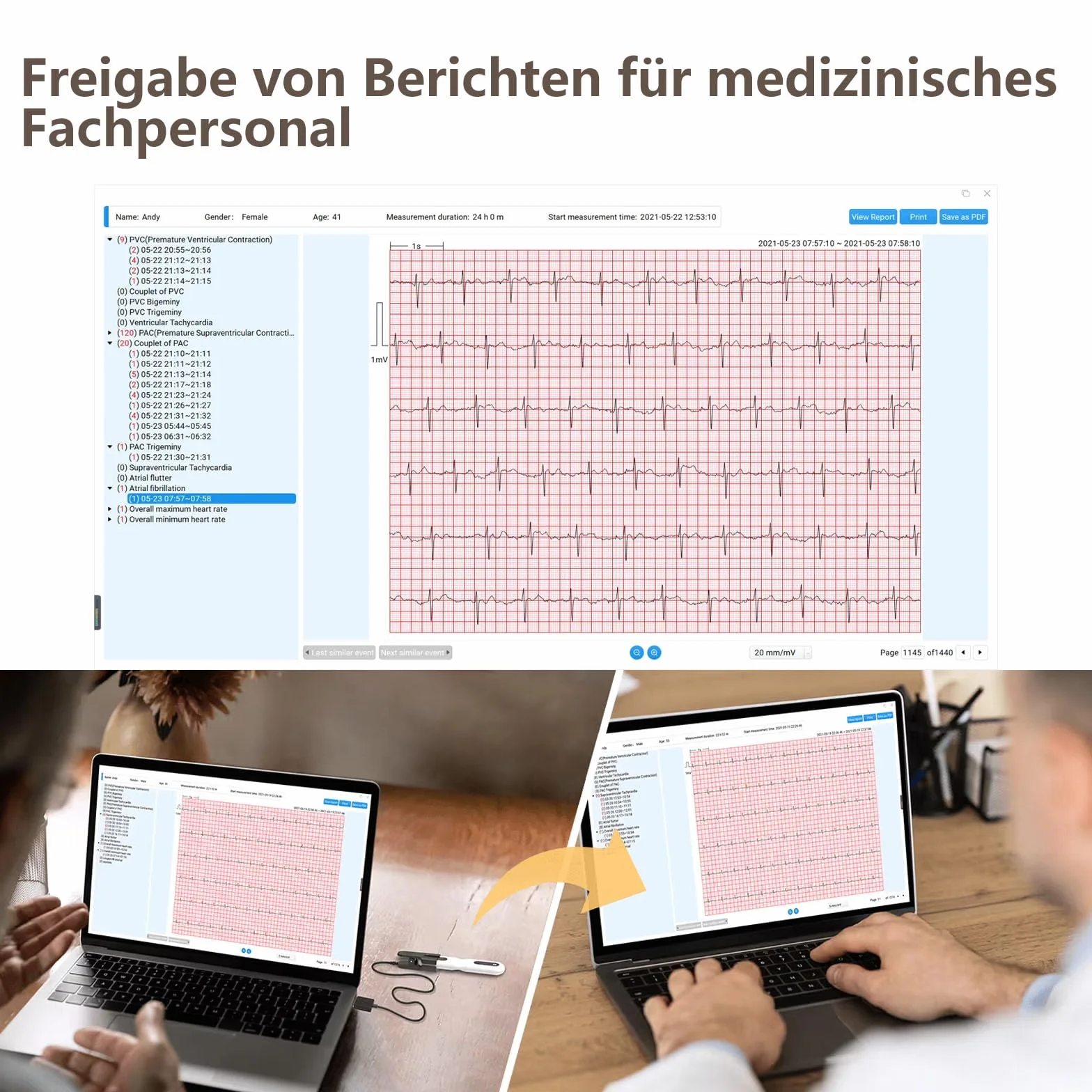 Wellue 24 ore dispositivo ECG per la casa, analisi AI, ECG Event Recorder, compatibile con Ios e Android, Mac e Windows, tempo di monitoraggio da 5 minuti a 24 ore