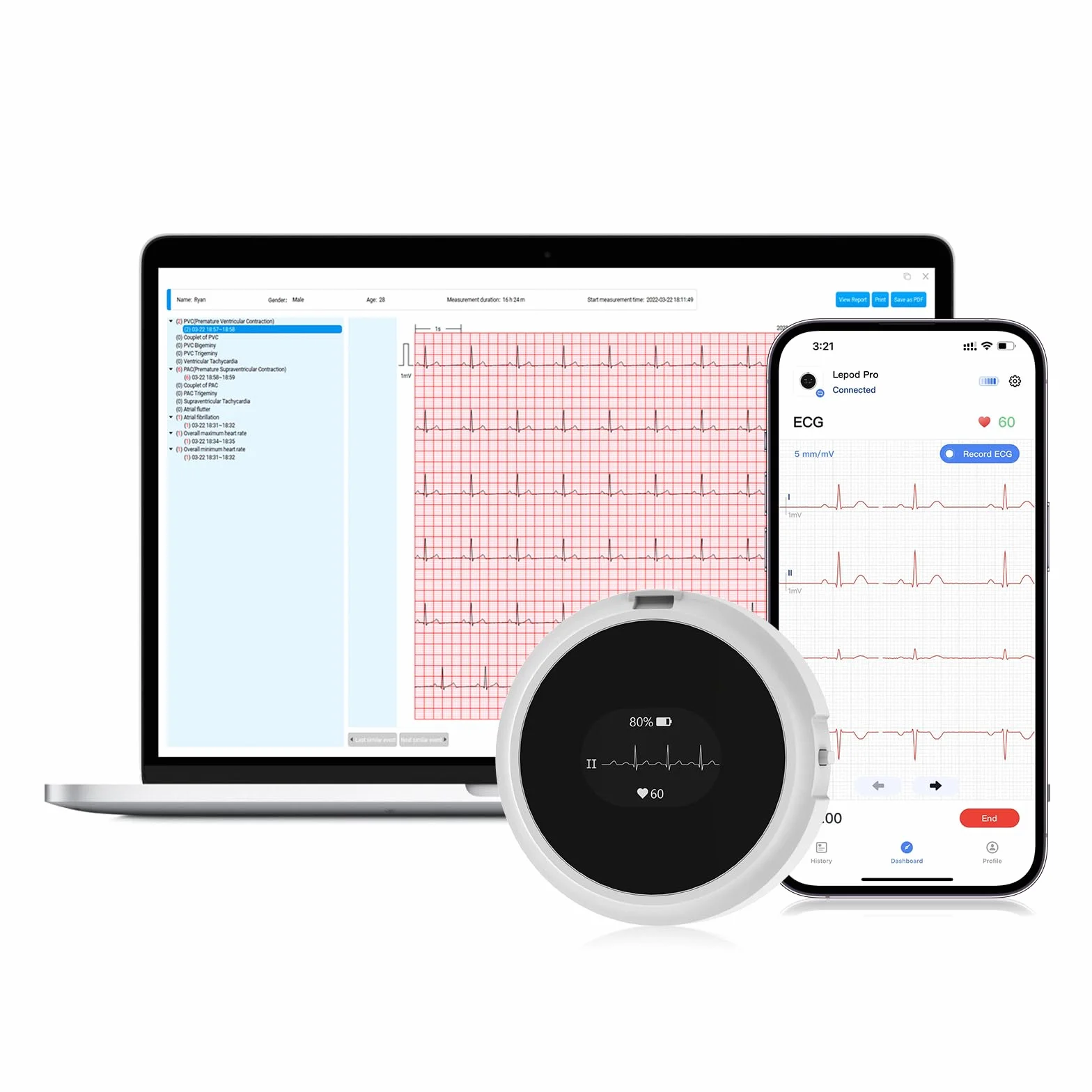 Wellue LP12 ECG portatile a 12 derivazioni con display OLED, registrazione ECG in tempo reale 24 ore su 24, rapporti ECG AI dettagliati, marcatori di eventi, ricaricabile, Supporta app mobile e PC